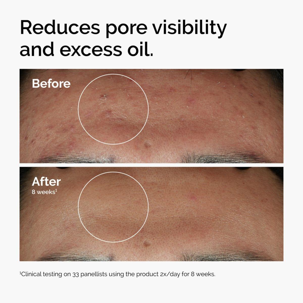 The Ordinary Niacinamide 10% Serum 30ml image 3